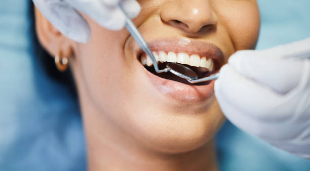 Best Emergency Dental Care for Sports Injuries in Corralitos, CA