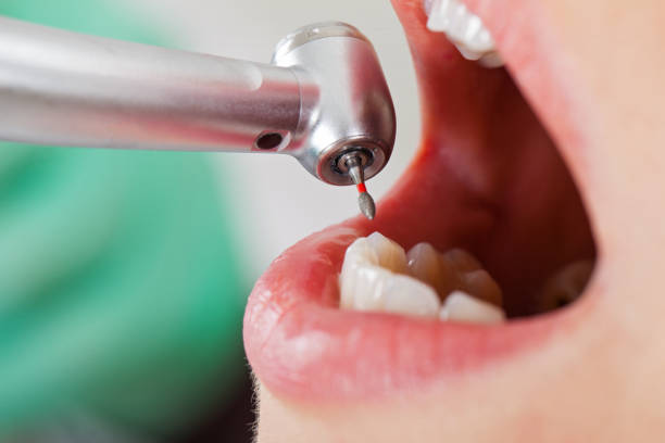 Best Emergency Treatment for Oral Infections in Corralitos, CA